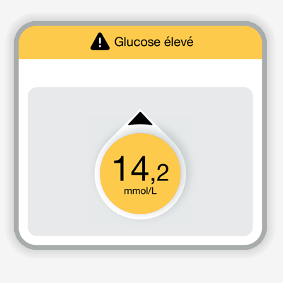 Dexcom G7