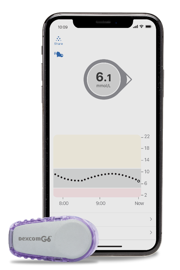 Dexcom G6 Continuous Glucose Monitoring