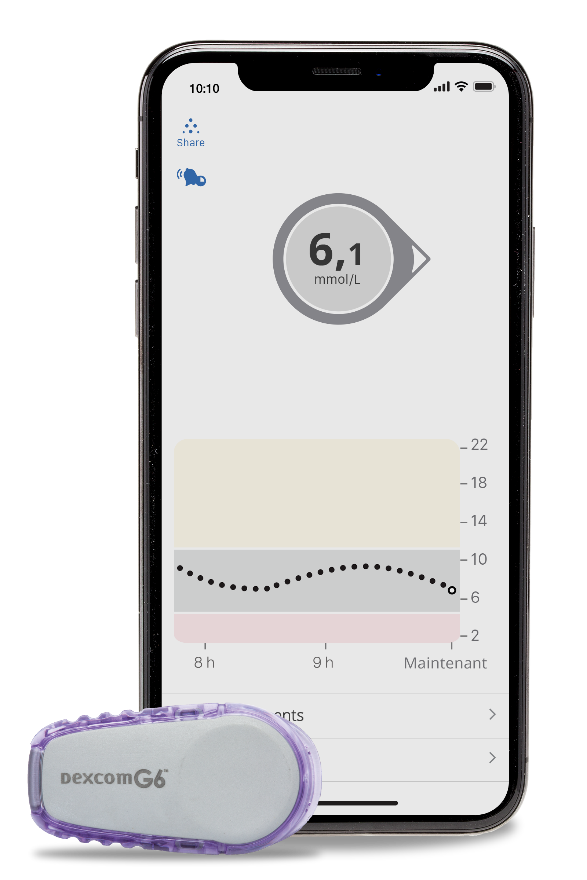 la surveillance du glucose en continu (SGC) Dexcom G6