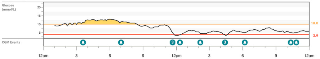 Mary's glucose chart